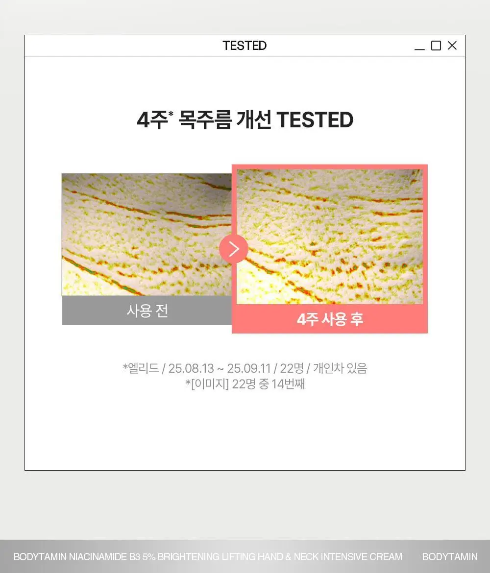 [NEW괄사형]비욘드 바디타민 핸드&넥크림 60ml(미백/주름/괄사케어) 3종 택1 상세페이지 40